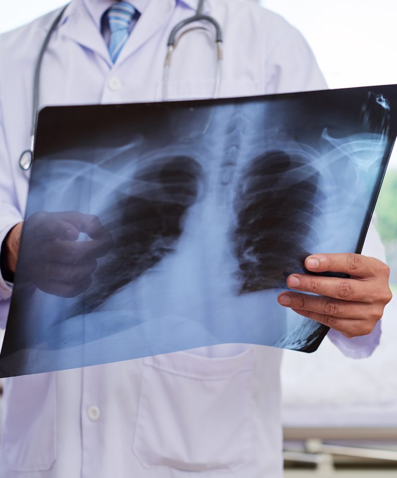 Doctor Looking at Chest Xray