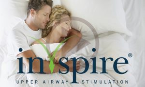 Inspire Therapy for Upper Airway Stimulation