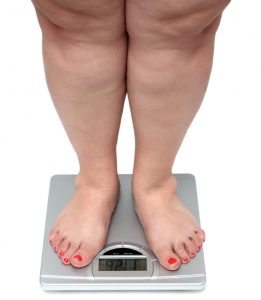 Overweight Person Standing on a Scale