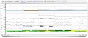 Sleep Profiler Diagnostic Report